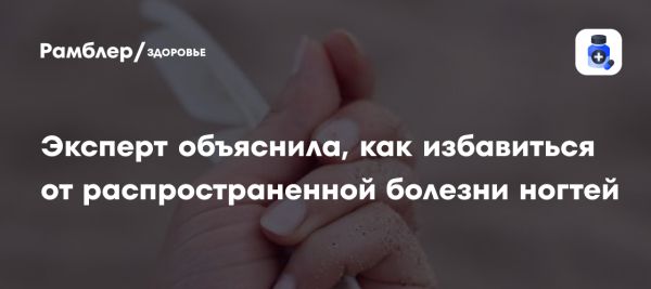 Советы по лечению онихолизиса от мастера маникюра Марии Герасимовой