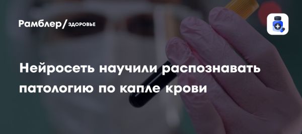 Приложение для диагностики заболеваний по капле крови от ученых Пензенского госуниверситета