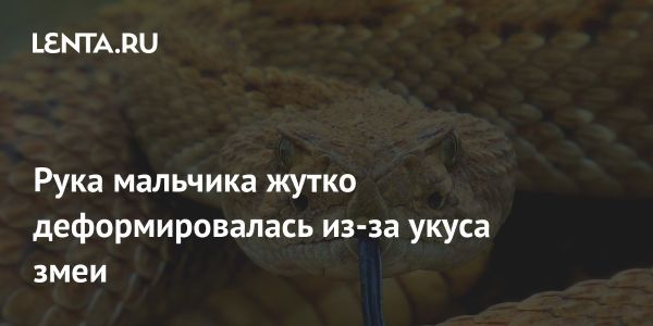 История Юсифа мальчика из Сьерра-Леоне который справился с последствиями укуса змеи