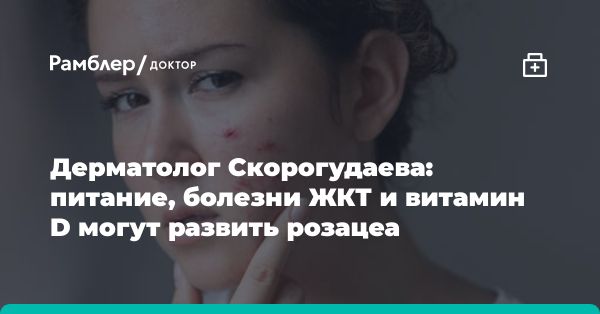 Розацеа: причины, лечение и профилактика