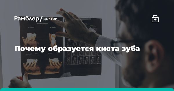 Кисты зубов: что это и как лечить