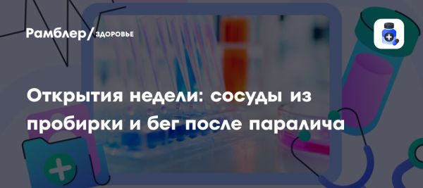 Исследование о влиянии сладких напитков на здоровье женщин