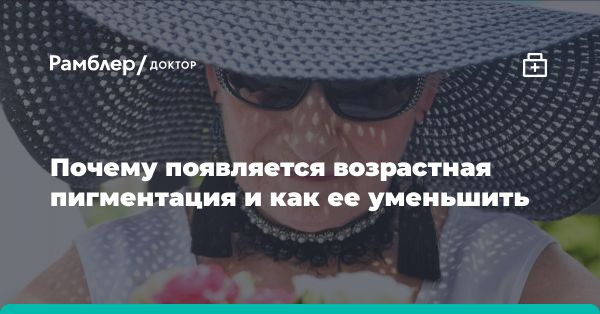 Профилактика возрастной пигментации кожи после 50 лет