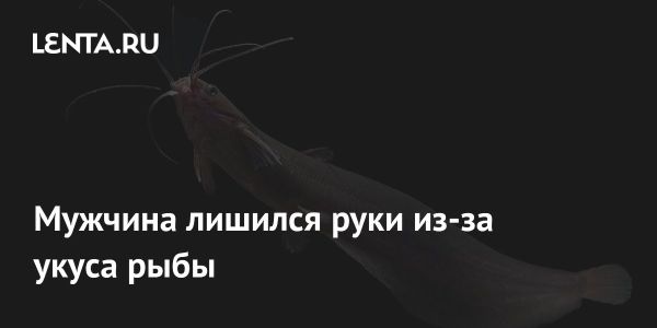 Опасный укус рыбы приводит к потере кисти у жителя Кералы