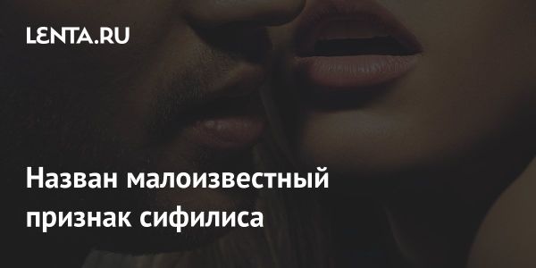 Необычные симптомы сифилиса: от облысения до бородавок