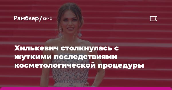 Актриса Анна Хилькевич и ее борьба с проблемами красоты