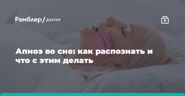 Апноэ сна: причины, лечение и рекомендации