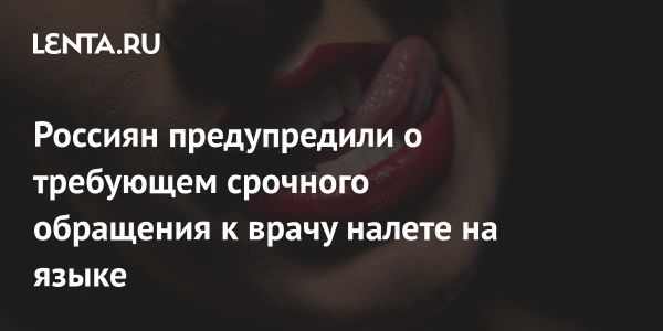 Признаки налета на языке и их значение для здоровья