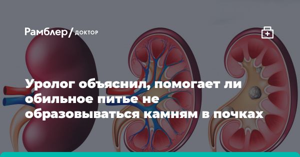 Как вода способствует предотвращению камней в почках: мнение профессора Малхасяна