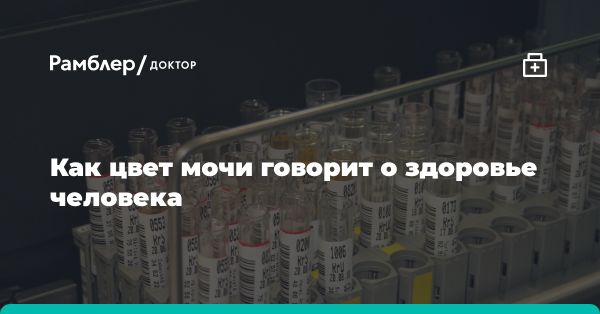 Цвет мочи и его значения: что говорит о здоровье