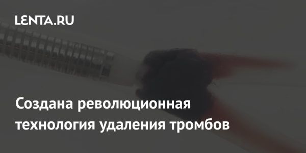 Инновационный метод удаления тромбов с помощью milli-spinner